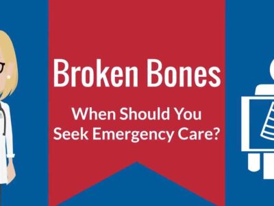 Broken Bones Emergencies