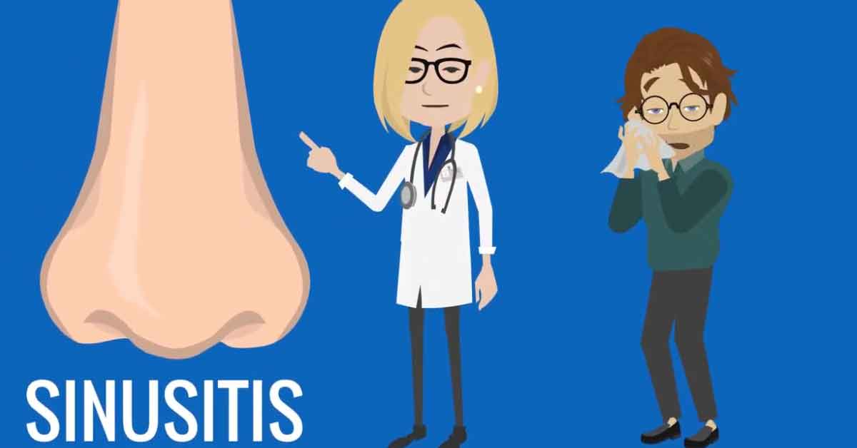 Sinusitis diagnosis and treatment