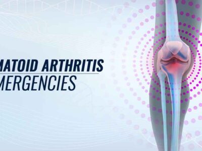 Rheumatoid Arthritis