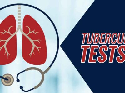 Tuberculosis Tests