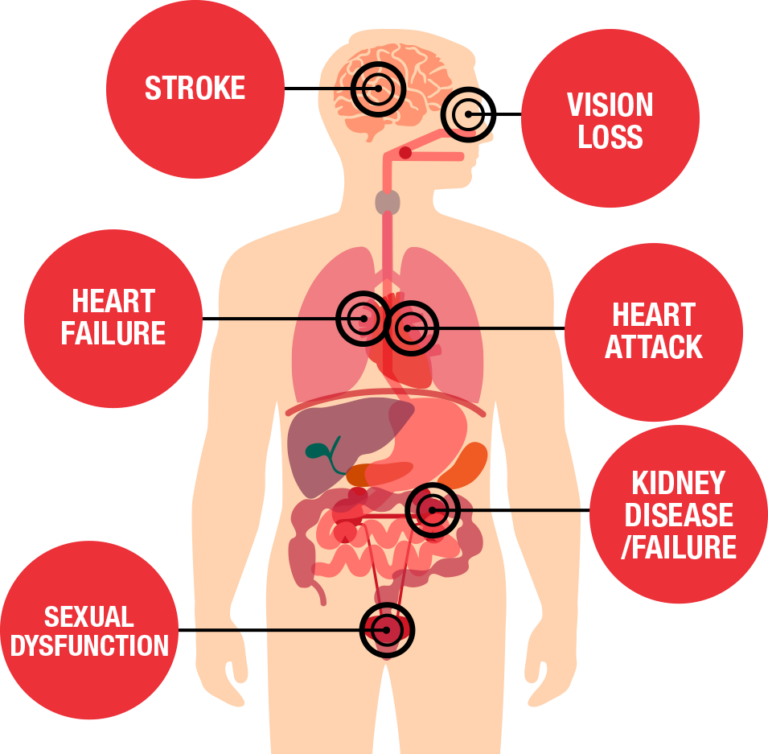 blood-pressure-complications-symptoms-elite-hospital-kingwood