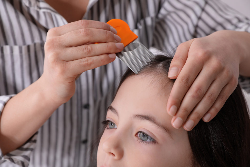 Treating and Preventing Head Lice In Children