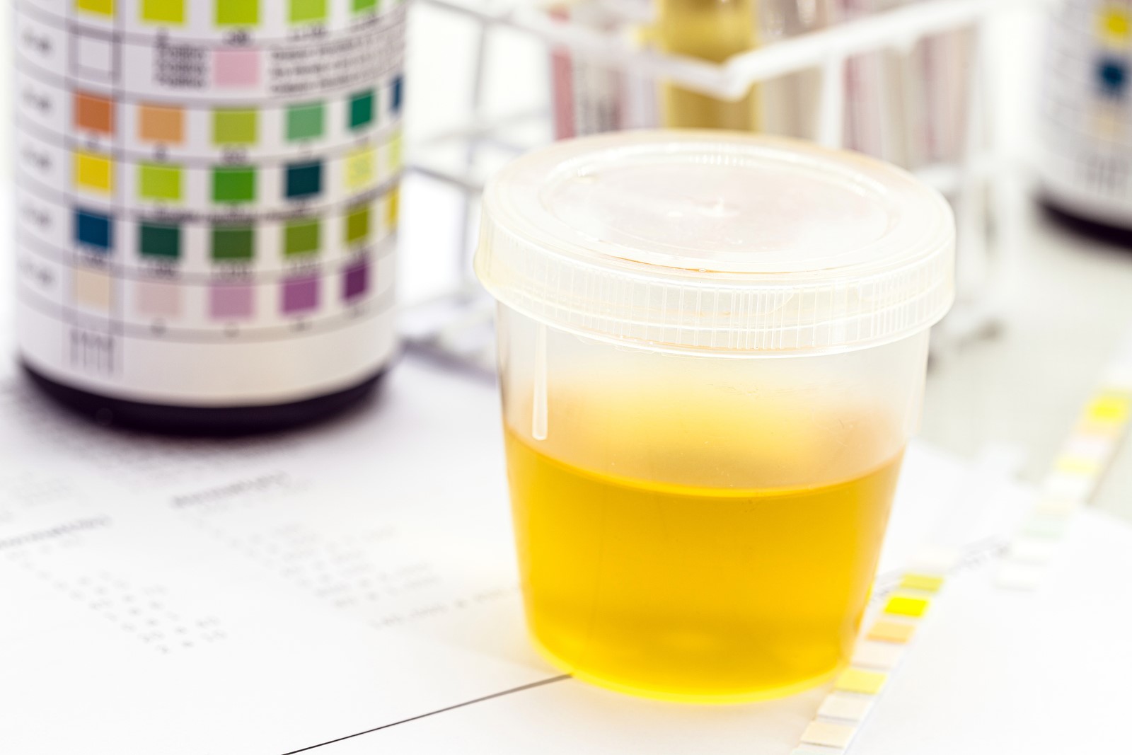 Blood In Urine
