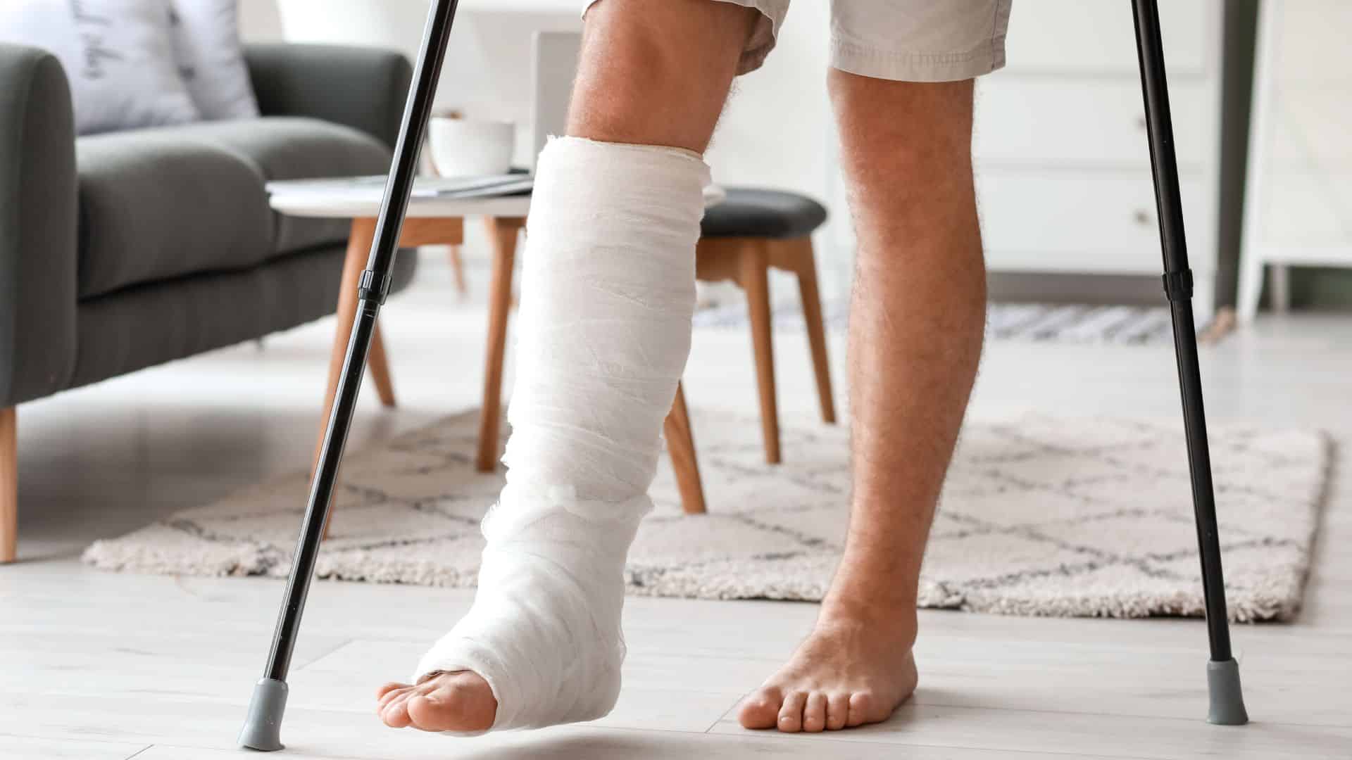 Broken ankle - Symptoms & causes - Mayo Clinic