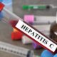 Diagnosis and Treatment of Hepatitis C