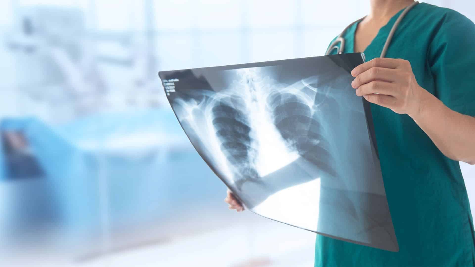 X-Ray Diagnostics